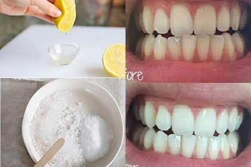 Không bao giờ đi lấy cao răng chỉ cần ngậm thứ này 2 phút, răng trắng như bọc sứ ngay