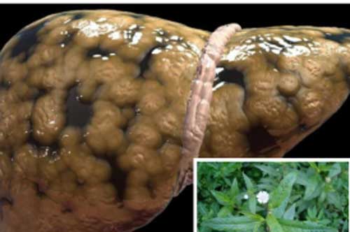 “Thoát” gan nhiễm mỡ nhờ cây cỏ mọc hoang bờ bụi, có rất nhiều ở Việt Nam nhưng vẫn bị bỏ qua