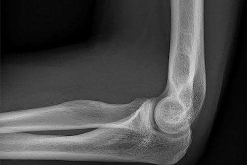 Giải mã 5 'lời đồn oan trái' về tia X-quang