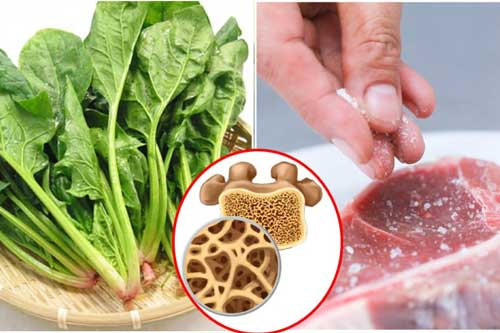 Những loại thực phẩm dễ phá hủy xương khớp, số 1 nhiều người mắc phải mà không hề biết