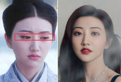 Cảnh Điềm bị chê 'giống ếch' khi công khai thẩm mỹ hỏng