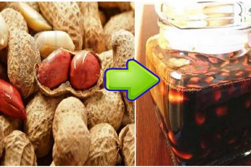 Lạc ngâm giấm - Bài thuốc thần kỳ chữa dứt điểm bệnh cao huyết áp, giảm mỡ trong máu