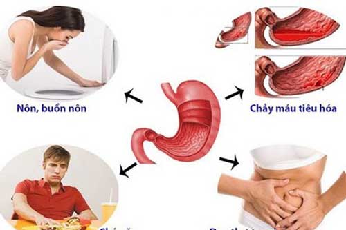 Những dấu hiệu cảnh báo đau dạ dày, rất nhiều người mắc bệnh mà không biết