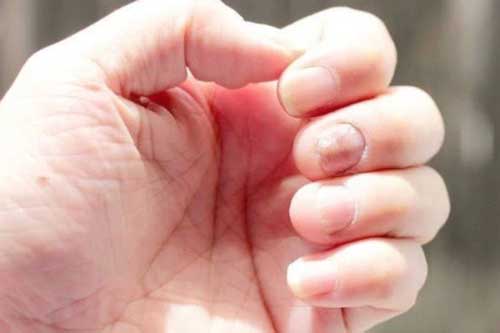 5 triệu chứng lặp đi lặp lại cảnh báo gan đang bị nhiễm độc, cần đi khám ngay