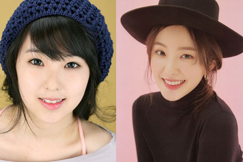 Những visual Kpop từng bị nghi phẫu thuật thẩm mỹ