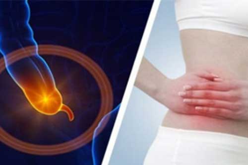 7 dấu hiệu viêm ruột thừa bạn nhất định đừng xem thường