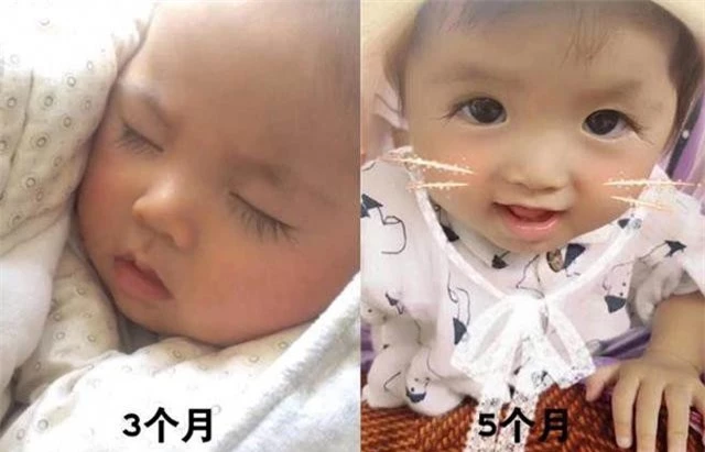 Lông mi của Niu Niu bắt đầu dài ra từ lúc 3 tháng tuổi. Đến lúc 5 tháng tuổi, lông mi của bé đã dài gấp 3 lần những đứa trẻ khác.
