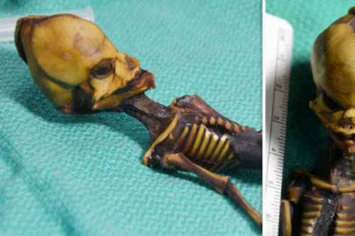 Nghiên cứu về hệ gen của bộ xương kỳ lạ Atacama là phi đạo đức