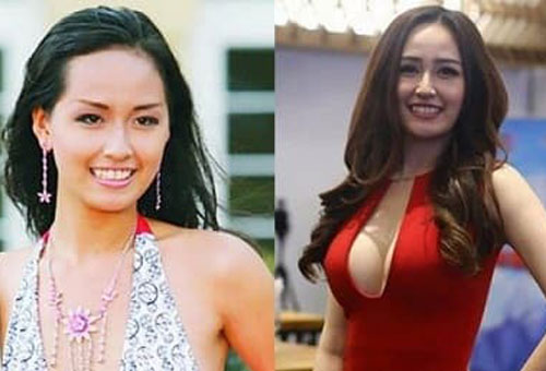 Mai Phương Thúy đã can thiệp bộ phận nào khi thừa nhận phẫu thuật thẩm mỹ?