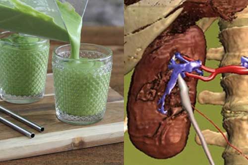 Lọc sạch mọi cặn bẩn trong thận chỉ trong 3 ngày nhờ vào ly nước ép đơn giản, dễ làm