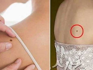 Vị trí nốt ruồi phát tài phát lộc, cả đời dễ giàu sang phú quý