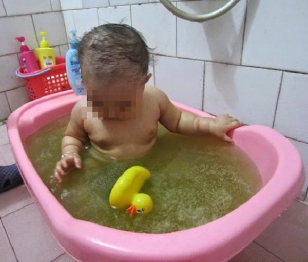 4 sai lầm của cha mẹ khiến bệnh da liễu mùa hè ở trẻ ngày càng nặng