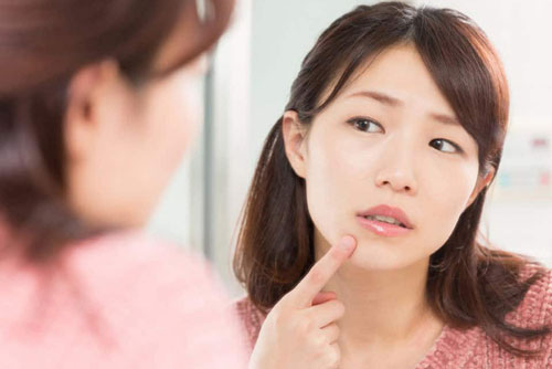 Top 5 cách trị mụn ẩn trên trán tại nhà, giúp nhân tự trồi lên không cần nặn