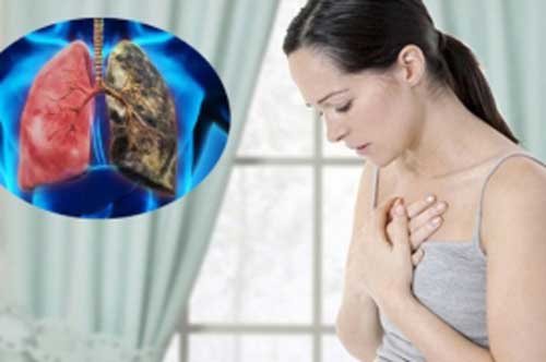5 tín hiệu "cầu cứu" của phổi, cần đi kiểm tra càng sớm càng tốt