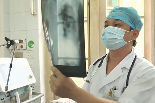 Chủ động chống bệnh lao như chống dịch COVID-19