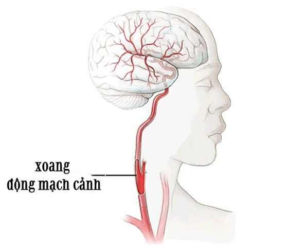 Cô dâu đột tử vì chú rể hôn quá mãnh liệt, 4 điểm trên cơ thể tránh tác động mạnh - 1