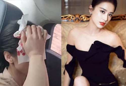 'Tiểu hoa đán' Huỳnh Thánh Y bị tai nạn trường quay, đầu chảy máu đến mức phải nhập viện