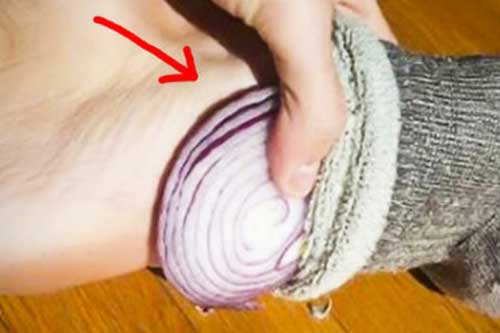Đặt hành tây lên bàn chân mỗi tối điều kỳ diệu sẽ xảy ra với cơ thể bạn