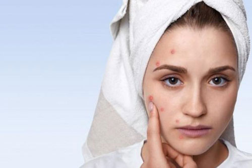 3 dấu hiệu cảnh báo bạn đã chăm sóc da sai cách