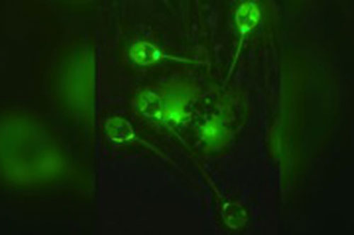 Phát hiện ra loài động vật đầu tiên sống không cần oxy