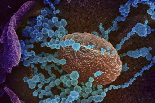 Các nhà khoa học Argentina tìm ra cơ chế né tránh miễn dịch của COVID-19