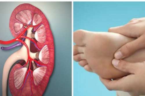 Bàn chân có 3 ba dấu hiệu sau là điềm báo sắp thận gặp nguy hiểm, hãy đến gặp bác sĩ ngay lập tức