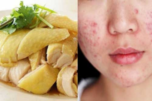 5 loại thực phẩm dễ khiến chị em bị rối loạn nội tiết tố, nên hạn chế sử dụng