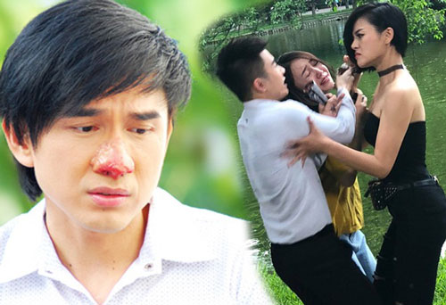 Hậu quả sau cảnh đánh ghen: Thu Quỳnh bị cỏ cào nát lưng, mũi Đan Trường sưng vù