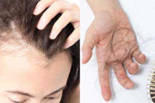 6 thói quen tai hại dễ khiến tóc rụng từng mảng, nhiều người Việt vẫn làm mỗi ngày