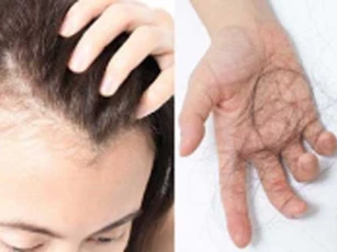 6 thói quen tai hại dễ khiến tóc rụng từng mảng, nhiều người Việt vẫn làm mỗi ngày