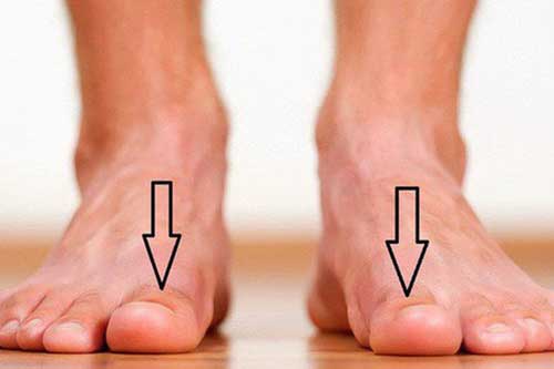 Dấu hiệu nhỏ trên bàn chân cảnh báo "trọng bệnh", nhiều người chủ quan đến khi đi khám thì đã quá muộn