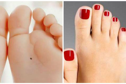 Bàn chân xuất hiện 3 dấu hiệu "xấu đau xấu đớn" này chẳng ai thích nhưng lại vô cùng hút lộc