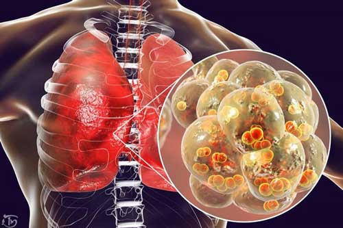 2 cách đơn giản của Đông y để chăm sóc phổi hiệu quả, giúp phổi sạch bong, thải hết độc cơ thể