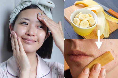Không cần mỹ phẩm đắt tiền, miếng vỏ chuối bạn vứt đi lại là "thần dược" chống lão hóa, diệt mụn nhọt, vết nám