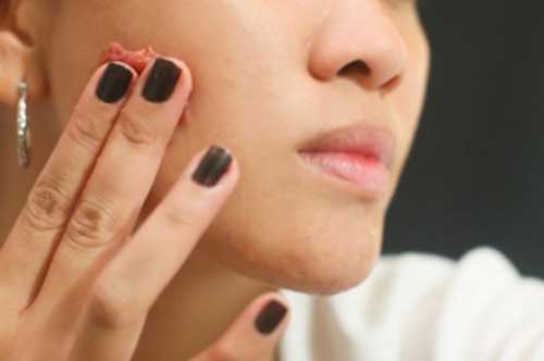 Da trắng mịn hiệu quả, hết sạch thâm nám nhờ chăm làm việc này mỗi tối