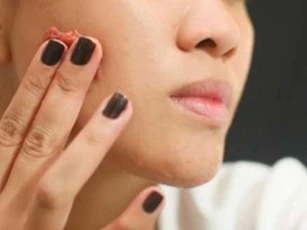 Da trắng mịn hiệu quả, hết sạch thâm nám nhờ chăm làm việc này mỗi tối