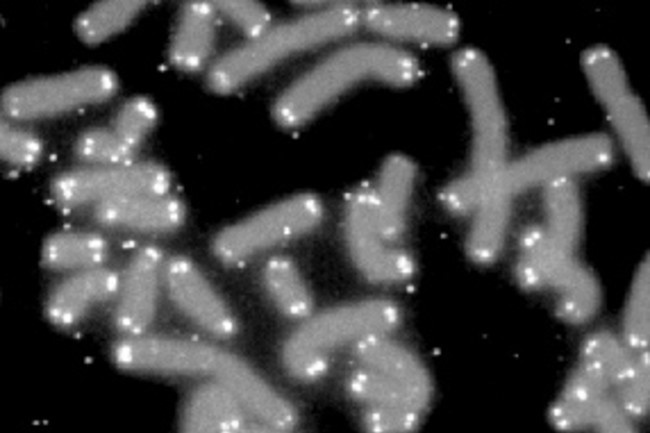 Con người có thể thực sự bất tử hay hồi sinh không?