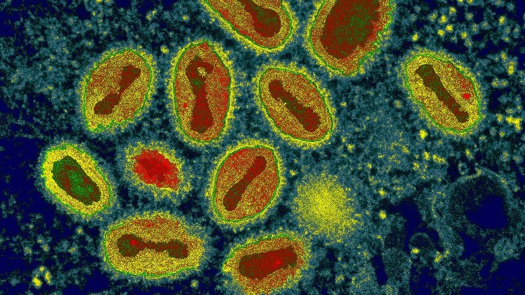 Virus variola gây bệnh đậu mùa. Ảnh: Sciencephoto.