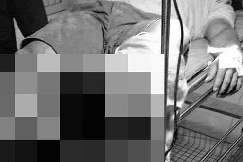 Tây Ninh: Thiếu niên 15 tuổi bị chém đứt lìa cẳng chân trong khi ẩu đả