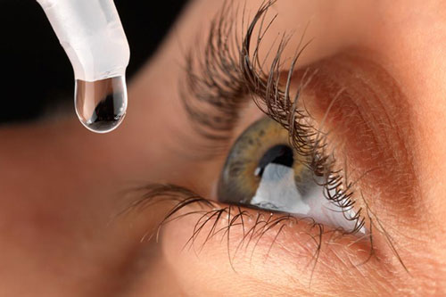 Cảnh báo đục thủy tinh thể do tự ý mua thuốc nhỏ mắt