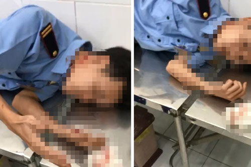 TP.HCM: Truy xét đối tượng đâm 3 bảo vệ bị thương vì bị nhắc nhở