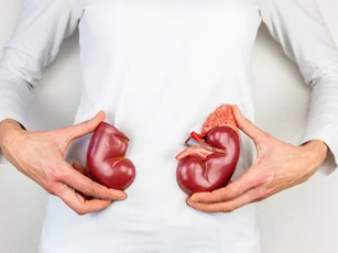 10 loại thực phẩm bổ dưỡng nhưng là đại kỵ với người bị bệnh thận