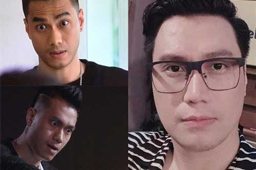 Tự tin đăng ảnh cận mặt sau 1 năm dao kéo, Việt Anh vẫn bị dân mạng chê bai nhan sắc