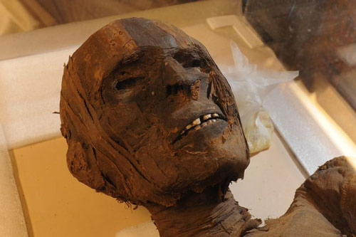 Chuyện bí ẩn đằng sau xác ướp 4.000 năm tuổi có các triệu chứng của bệnh tim