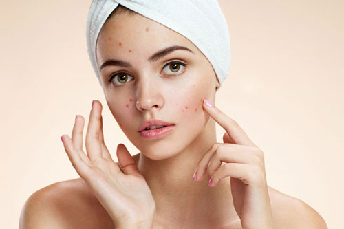 Nước ép cà rốt và công dụng thần kỳ trong việc trị mụn