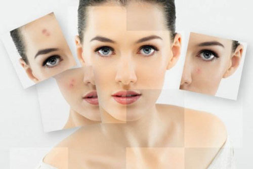 Tuyệt chiêu khiến mụn biến mất sau một… đêm