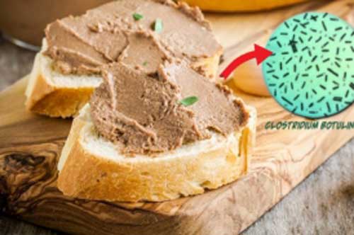 Dấu hiệu thực phẩm nhiễm botulinum - chất cực độc có trong loại pate đang khiến nhiều người nhập viện nguy kịch