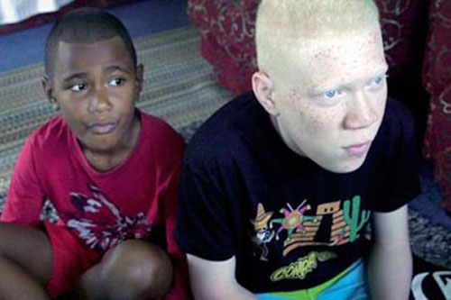 Gene bạch tạng trên đảo Fiji