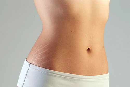 Bí quyết đánh bay các vết rạn da bằng những thực phẩm có trong nhà bạn