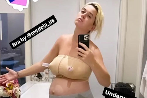 Katy Perry khoe ảnh 5 ngày sau sinh